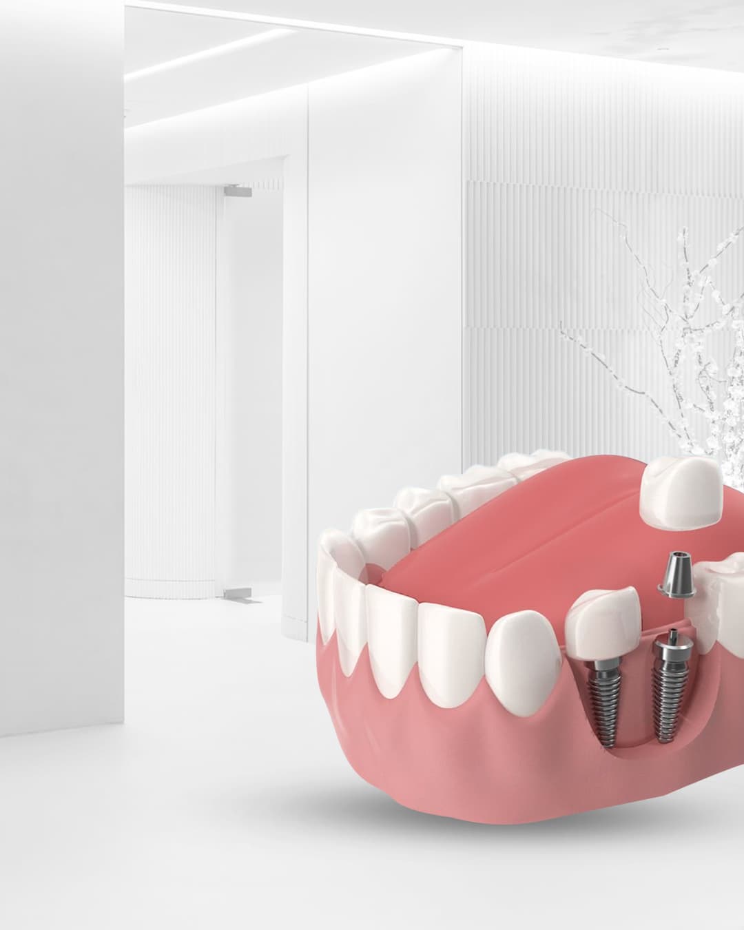 Dental implant model showing a titanium implant and crown